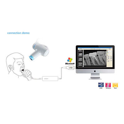Tragbare zahnmedizinische X-Ray-Maschinen-Handkamera für die endodontische Behandlung