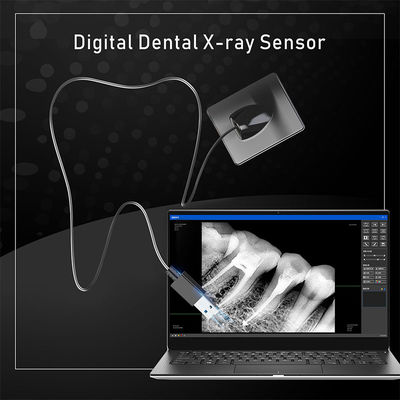 Dental-Röntgen-Digitalsensor für Zahnimplantate und endodontische Behandlung