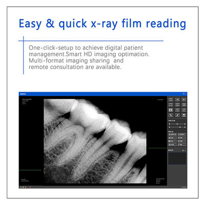 Dental-Röntgen-Digitalsensor für Zahnimplantate und endodontische Behandlung