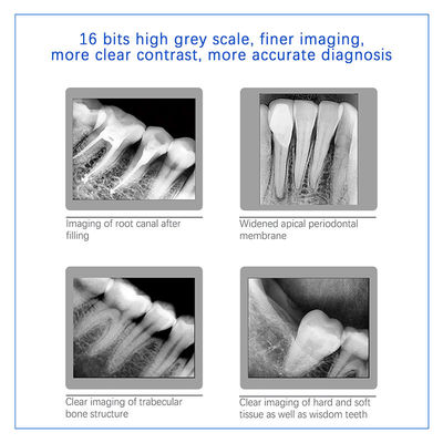 Dental-Röntgen-Digitalsensor für Zahnimplantate und endodontische Behandlung